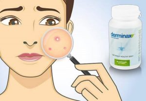 Derminax Recenze – Nový skin-čistící formule s kopřiva a přeslička extrakty!