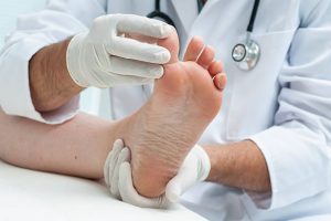 Plísňová infekce na nohou – Příznaky a léčba