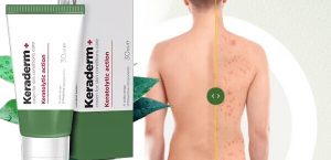 KeraDerm+ Recenze – Přírodní krém na houby a pokožku nohou bez plísňových infekcí
