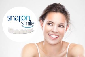 Snap-On Smile – rychlé řešení pro zářivý úsměv! Recenze zákazníků a cena!